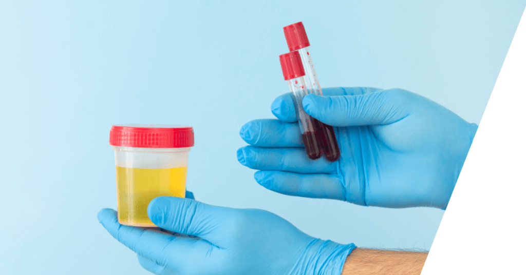 male infertility Urinalysis